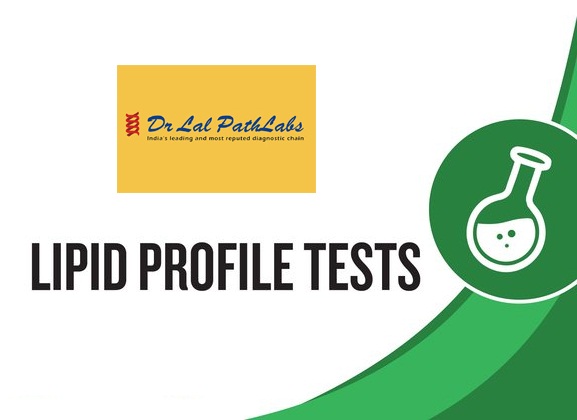Lipid Profile (5 Tests)