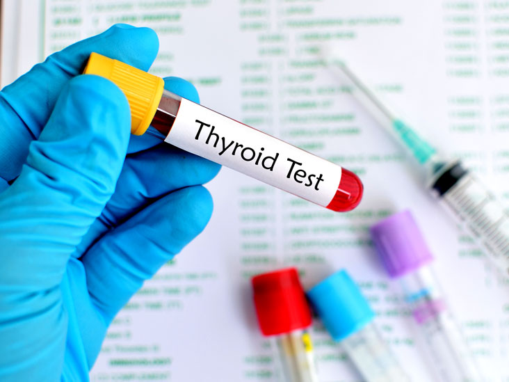 Thyroid Profile (3 Tests)