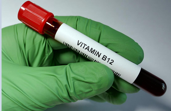 Vitamin B12 (1 Test)